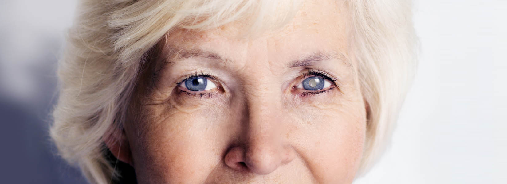 Cataract Surgery in Tucson